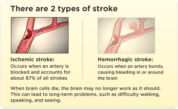 How does a stroke occur