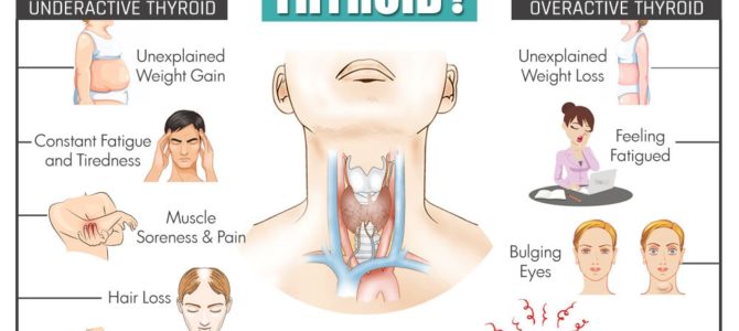 World Thyroid Day 25th May