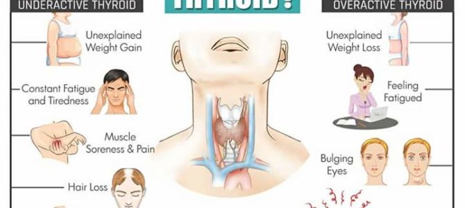 All about thyroid