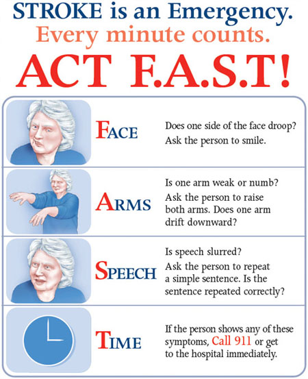 Stroke warning signs