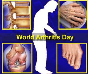 World Arthritis Day 2017